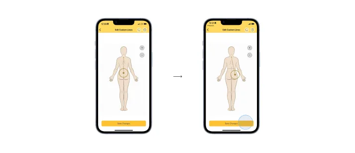 Editing the length and position of an active custom measurement line.