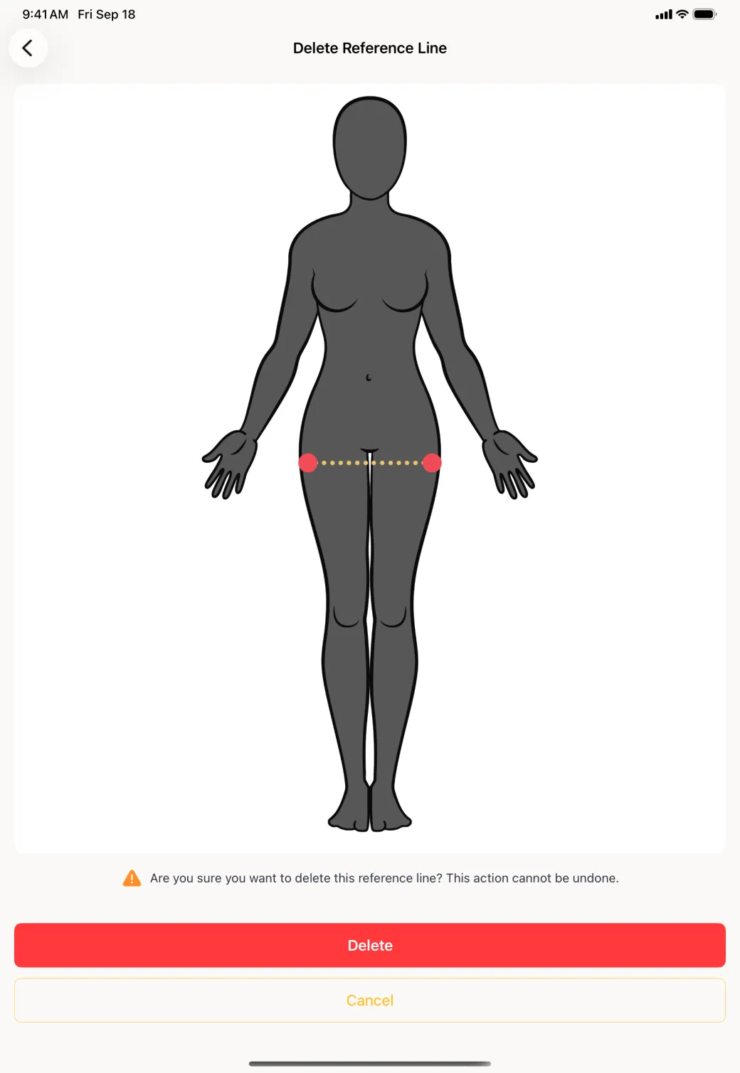 A Delete Reference Line page showing the figure with the guide line drawn in gold between two red endpoints, a warning line asking whether you are sure because the action cannot be undone, and red Delete and Cancel buttons.